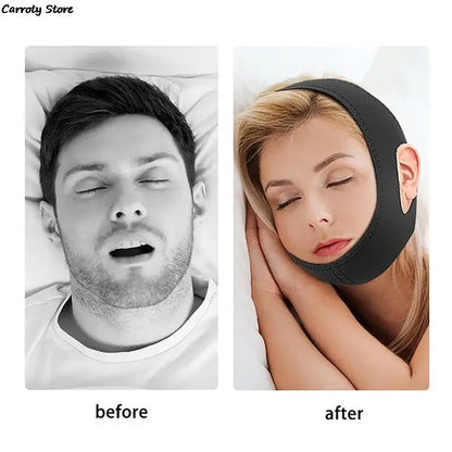 Adjustable New Neoprene Anti Snoring Treatment Snore Relieve for Sleep